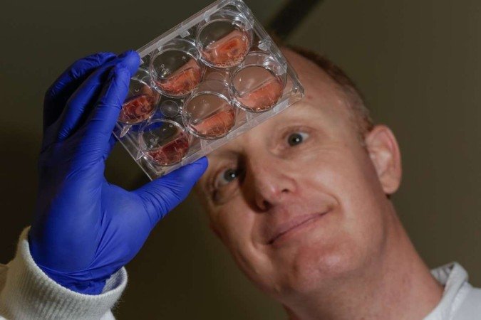 O cientista Mark Pearson analisa amostra do Schistosoma haematobium, um dos parasitas causadores da esquistossomose - (crédito: Eureka/Romy Bullerjahn) O cientista Mark Pearson analisa amostra do Schistosoma haematobium, um dos parasitas causadores da esquistossomose - (crédito: Eureka/Romy Bullerjahn)