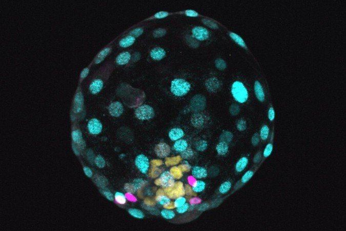 2021. Crédito: Rivron/Nature/IMBA/Divulgação. Saúde. Blastoide humano marcado com fluorescência nas juntas (amarelo), juntas de aderência (magenta) e domínio apical (cyano).