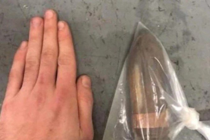 Esquadrão Anti Bombas é acionado em Hospital na Inglaterra após atender um paciente com um projétil de artilharia introduzido no reto. - (crédito: Reprodução/The Sun) Esquadrão Anti Bombas é acionado em Hospital na Inglaterra após atender um paciente com um projétil de artilharia introduzido no reto. - (crédito: Reprodução/The Sun)