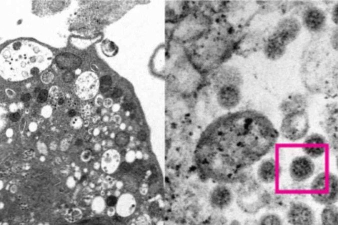 A variante Ômicron foi identificada pela primeira vez na África do Sul - (crédito: Divulgação/ Faculdade de Medicina da Universidade de Hong Kong) A variante Ômicron foi identificada pela primeira vez na África do Sul - (crédito: Divulgação/ Faculdade de Medicina da Universidade de Hong Kong)