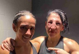 Boxeadora espanhola fica irreconhecível após levar 236 socos no rosto