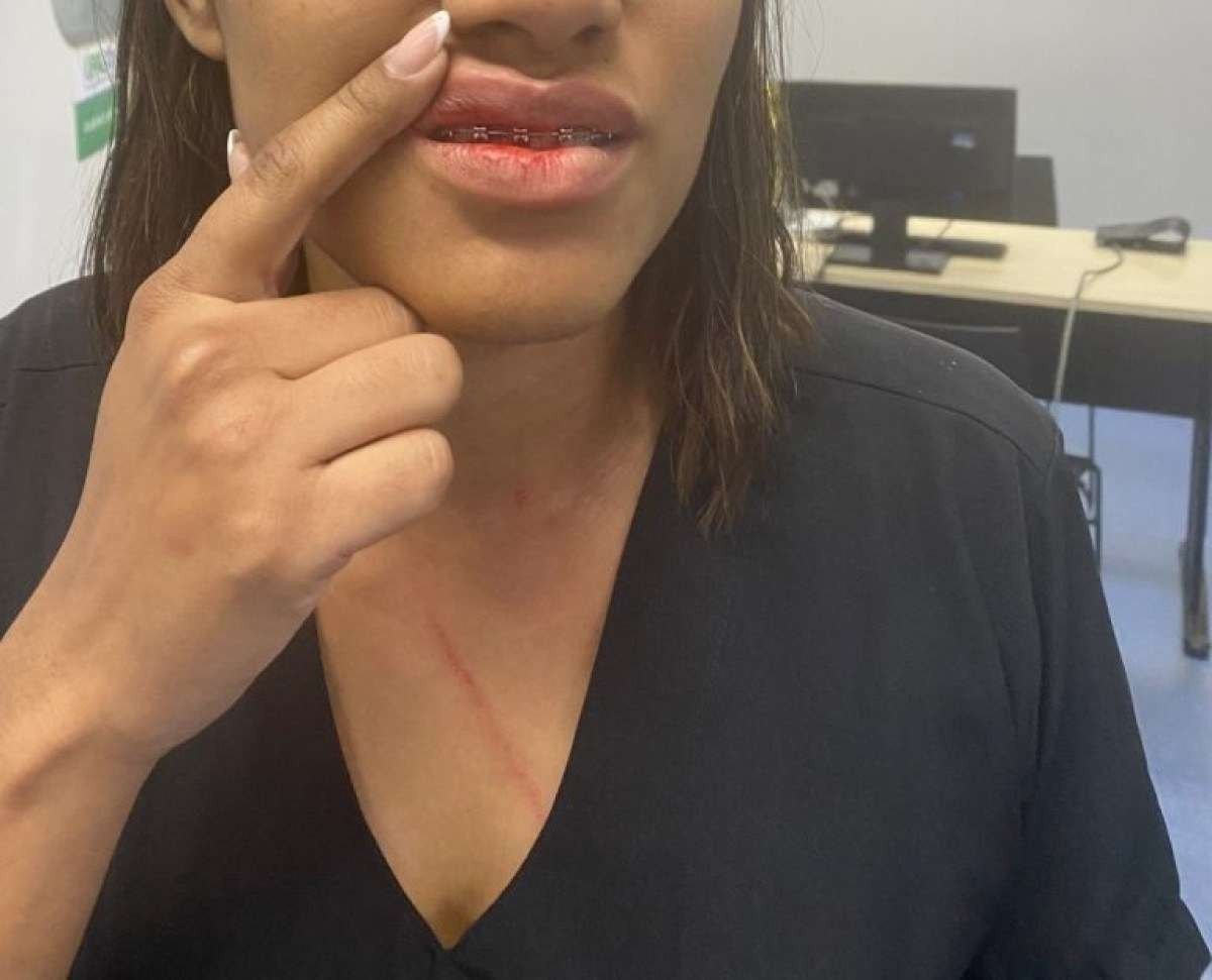 Chega de violência, pede Coren-DF após agressão a enfermeira de UPA