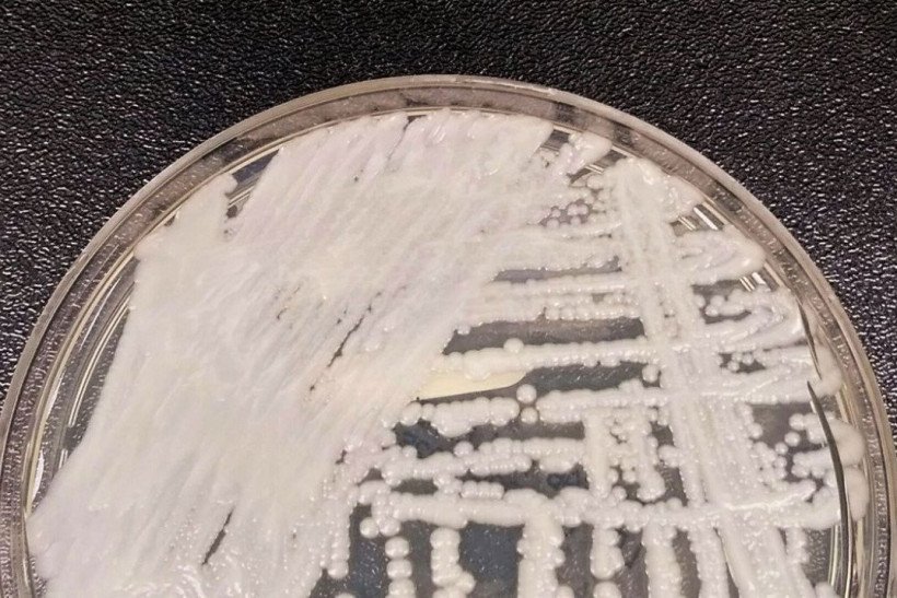 Confirmado segundo caso de Candida auris em Pernambuco 