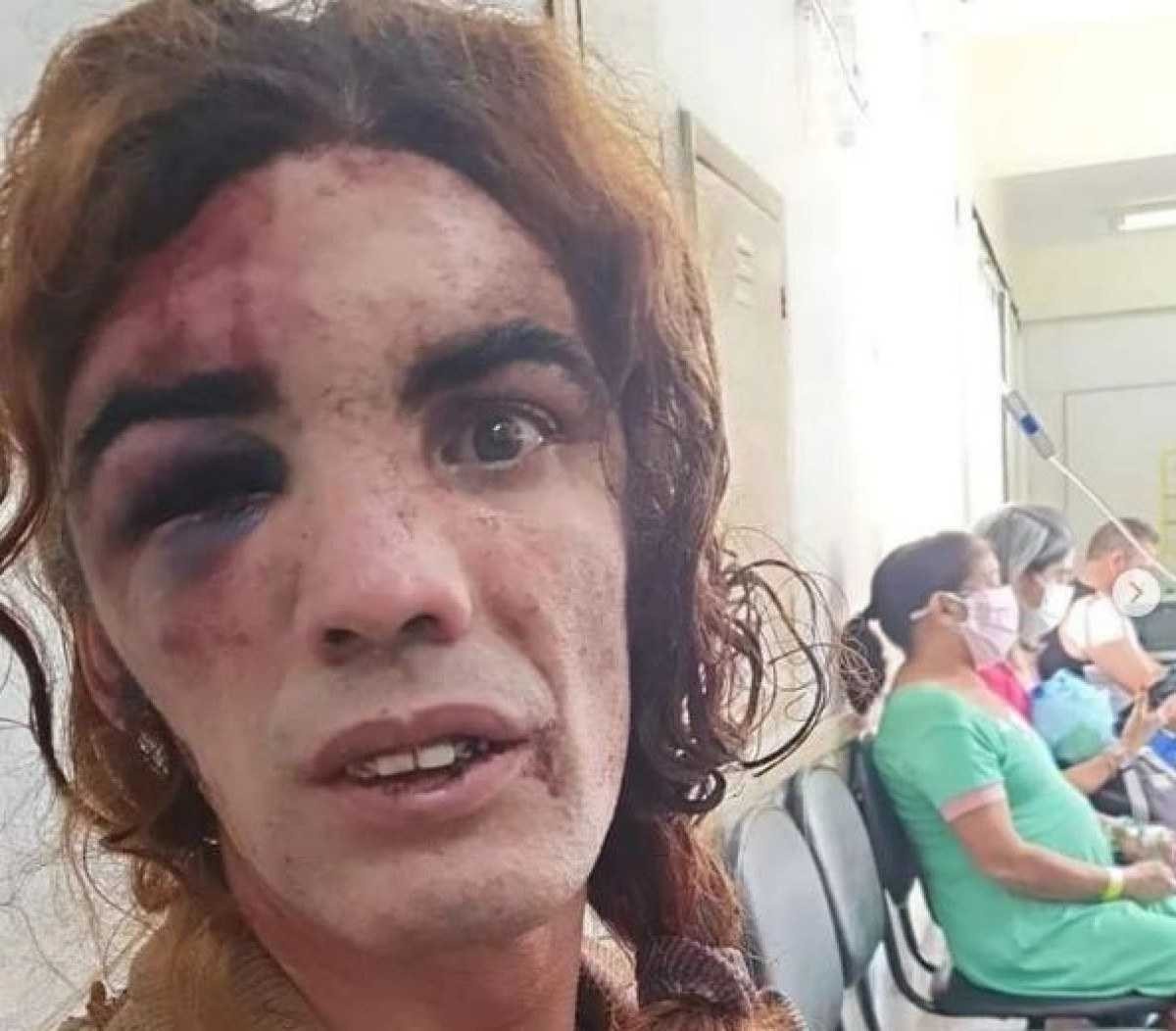 Homem que espancou mulher trans é condenado a seis meses em regime aberto