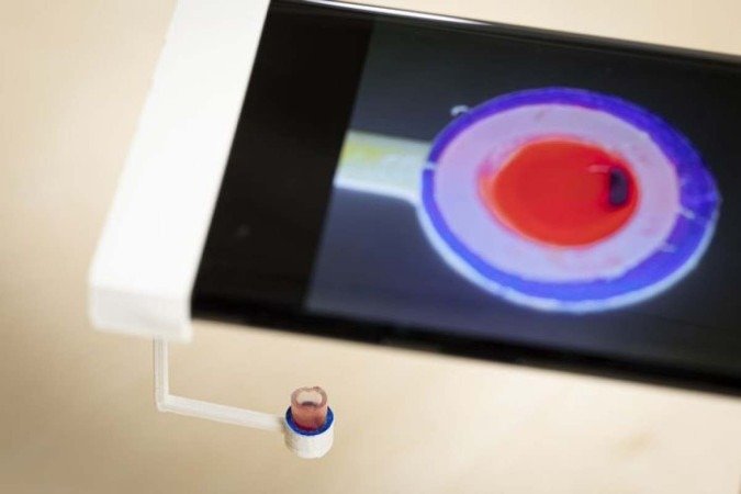 O dispositivo que lê a amostra é acoplado a um telefone celular, evitando a ida ao laboratório - (crédito: Mark Stone/University of Washington) O dispositivo que lê a amostra é acoplado a um telefone celular, evitando a ida ao laboratório - (crédito: Mark Stone/University of Washington)