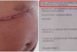 Homem espera 11 anos para retirar hérnia e sai de hospital sem vesícula