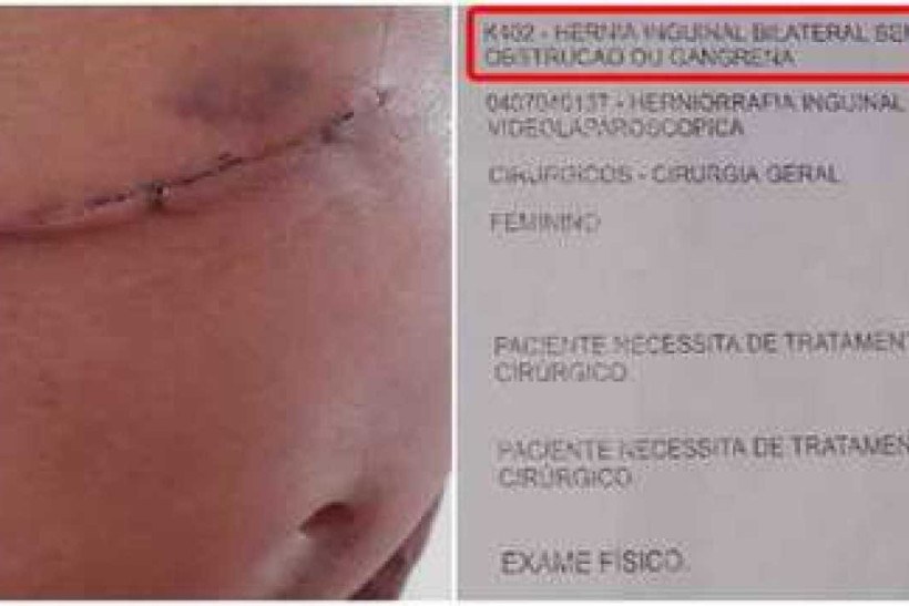 Ferreira passará por cirurgia para retirada de hérnia inguinal