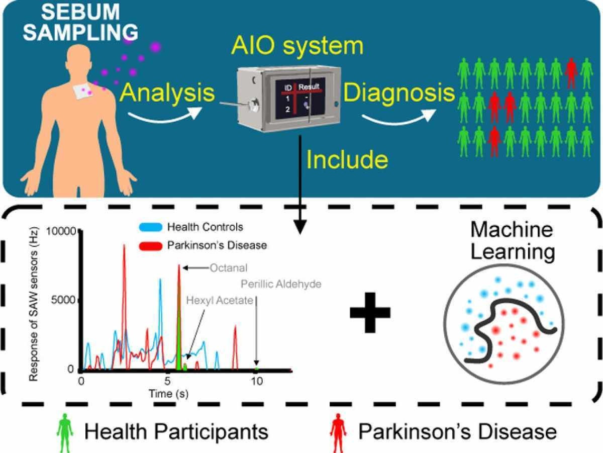 'Nariz eletrônico' será capaz de detectar doença de Parkinson pelo cheiro 