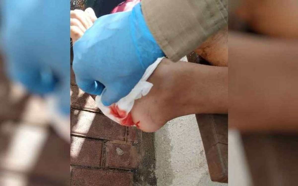 Banhista é vítima de ataque por piranhas em Caldas Novas (GO)