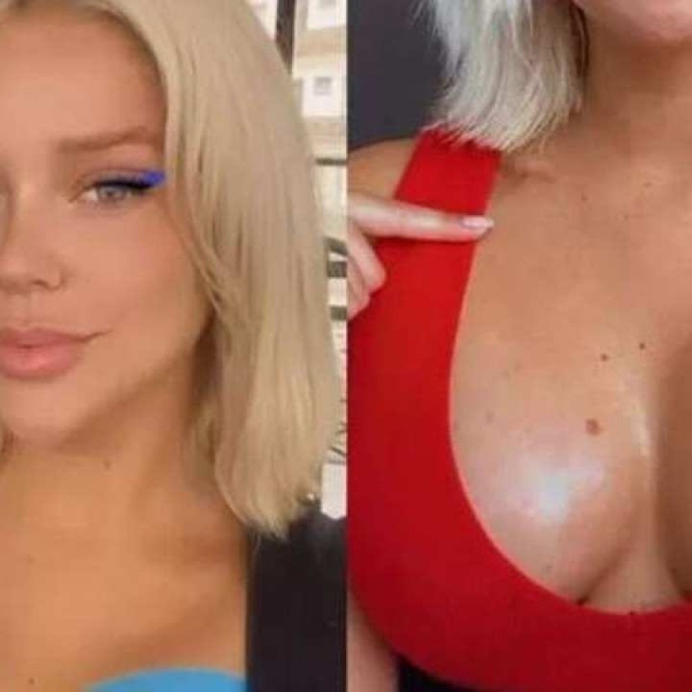 Bombshell Bra Before And After