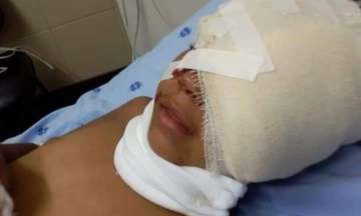 Mulher salva a filha de ataque de Pitbull; criança está internada
