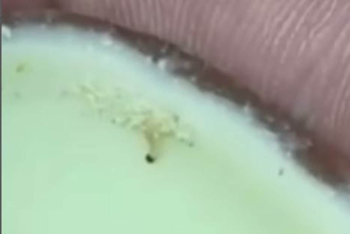 Casal encontra larvas em Kinder Ovo em São Paulo; empresa se manifesta