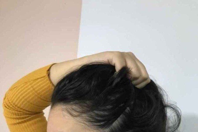 Mariana depois do tratamento com suplementos manipulados: resultado visível 