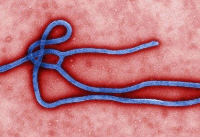 Este surto é particularmente desafiador porque envolve uma espécie rara de Ebola para a qual não existe vacina -  -Este surto é particularmente desafiador porque envolve uma espécie rara de Ebola para a qual não existe vacina - 