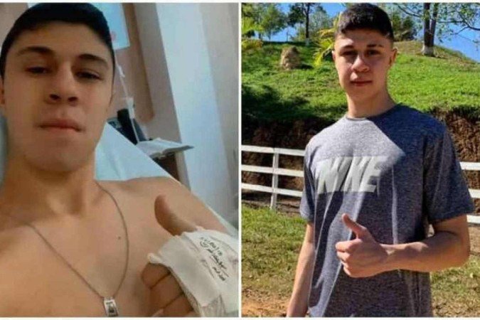 Além da amputação, Lucas de Paula da Silva, de 21 anos, teve queimaduras nos braços, na barriga e nas pernas - (crédito: Arquivo Pessoal) Além da amputação, Lucas de Paula da Silva, de 21 anos, teve queimaduras nos braços, na barriga e nas pernas - (crédito: Arquivo Pessoal)