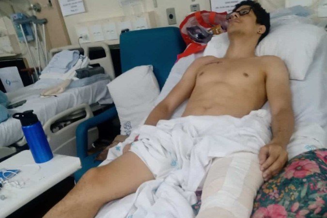 Paciente aguardou por duas semanas no HBDF para cirurgia. Com a demora, família decidiu vender a própria casa, no Gama, e arcar com os custos da cirurgia, em um hospital particular de Águas Claras -  (crédito: material cedido ao Correio)