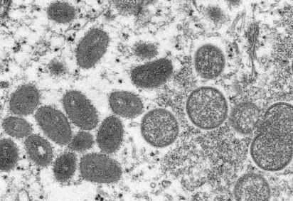 Somando os casos confirmados pelo laboratório de referência nacional (5) e os resultados do laboratório privado (4), o DF tem, ao todo, nove casos positivos para a varíola do macaco -  (crédito:  AFP)