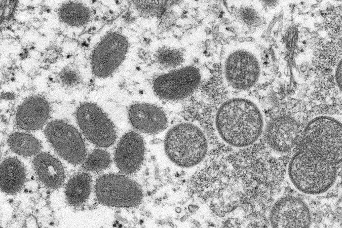 Vírus é transmissível pelo contato com pessoas ou superfícies -  (crédito:  AFP)