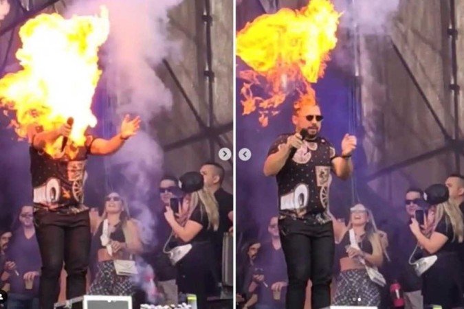 Nesta terça-feira (24/5) o cantor de forró compartilhou no Instagram imagens do momento exato quando o efeito do show foi acionado e ele queimou o braço - (crédito: Reprodução/Instagram) Nesta terça-feira (24/5) o cantor de forró compartilhou no Instagram imagens do momento exato quando o efeito do show foi acionado e ele queimou o braço - (crédito: Reprodução/Instagram)
