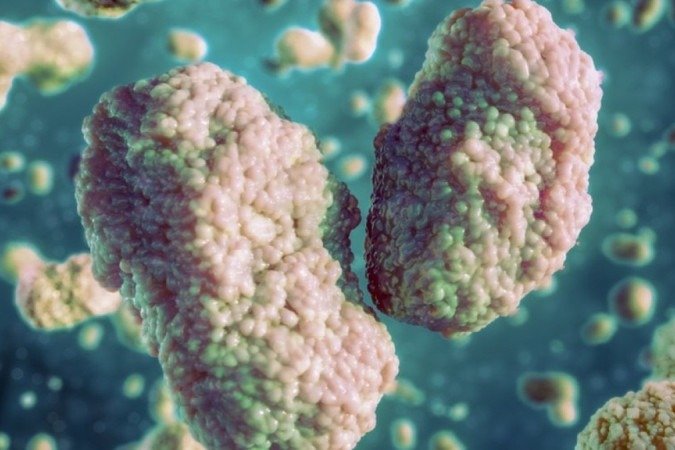 No surto atual, Grã-Bretanha, Portugal, Espanha, Estados Unidos e Canadá estão entre os países com casos suspeitos ou já identificados - (crédito: Science Photo Library) No surto atual, Grã-Bretanha, Portugal, Espanha, Estados Unidos e Canadá estão entre os países com casos suspeitos ou já identificados - (crédito: Science Photo Library)