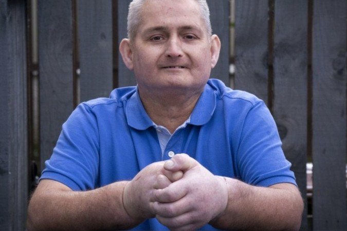A cirurgia de Steven teve a participação de 30 profissionais - (crédito: PA Media) A cirurgia de Steven teve a participação de 30 profissionais - (crédito: PA Media)