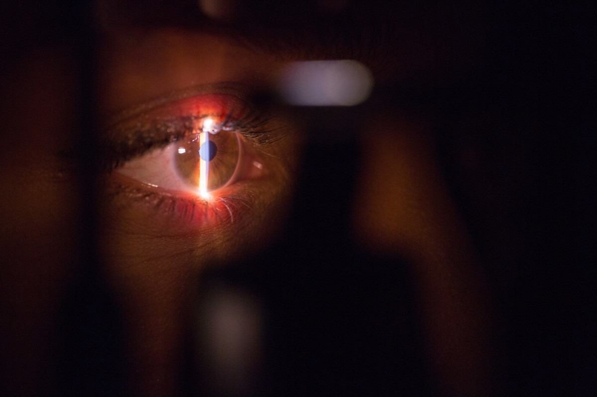 Glaucoma: como detectar e tratar doença que pode levar à cegueira