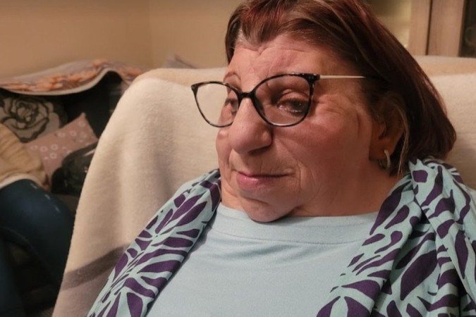 Janet Craven nasceu com uma doença genética rara chamada síndrome de Treacher Collins - (crédito: BBC) Janet Craven nasceu com uma doença genética rara chamada síndrome de Treacher Collins - (crédito: BBC)