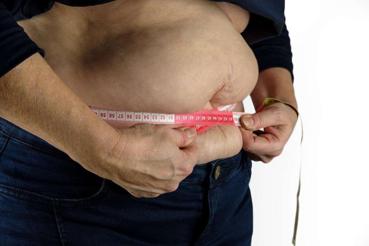 Visão do Correio: Entre a obesidade e o sobrepeso 