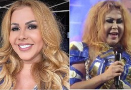 Joelma é internada com esofagite e edema após pegar covid-19 quatro vezes