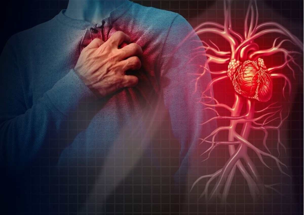 Pessoas que sofrem com enxaqueca têm mais risco de sofrer AVC e infarto