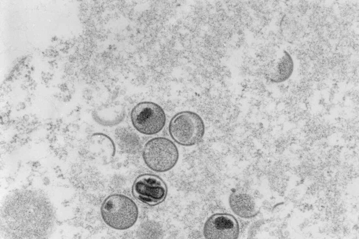 Disseminação global da varíola do macaco em 2022 serve de alerta