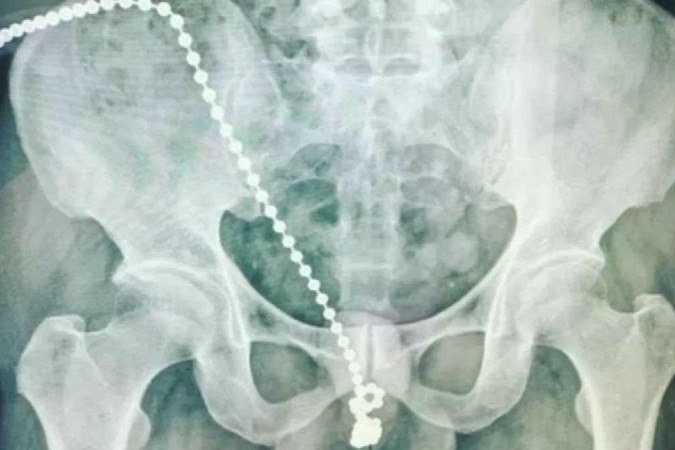 (crédito: Divulgação/ Universidade Médica de Taipé) (crédito: Divulgação/ Universidade Médica de Taipé)