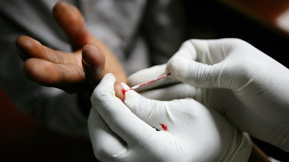 O que torna a população negra mais vulnerável ao HIV e a morrer por complicações da Aids