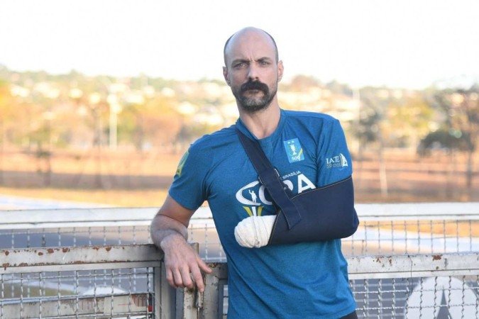  04/07/2022. Crédito: Ed Alves/CB/D.A Press. Brasil. Brasília - DF. Cidades. O policial militar reformado Leandro Percivalli Nascimento, 37 anos, teve a mão esquerda decepada após tentar defender uma mulher que era ameaçada de morte pelo namorado armado com um facão, na 905 da Asa Norte