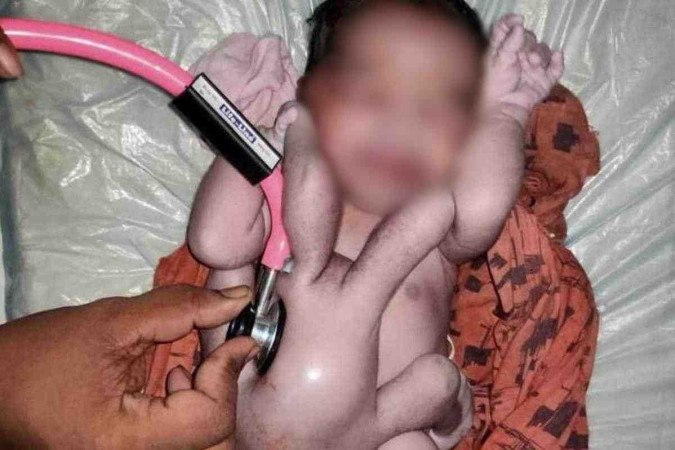 O bebê nasceu no Shahabad Community Health Center, no estado de Uttar Pradesh, a região mais populosa da Índia, pesando 2,948 kg -  (crédito: Newslions / SWNS)