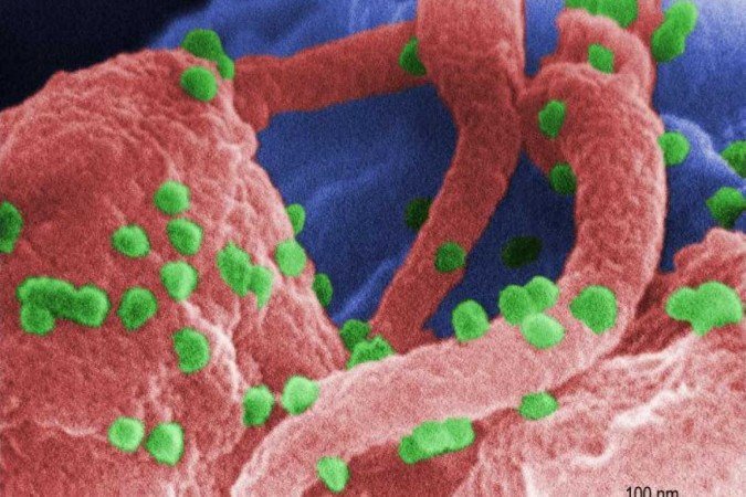 (crédito: Photo Credit: C. Goldsmith, P. Feorino, E. L. Palmer, W. R. McManus, CDC/Divulgação ) (crédito: Photo Credit: C. Goldsmith, P. Feorino, E. L. Palmer, W. R. McManus, CDC/Divulgação )