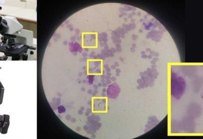  (crédito: Center of Research on Inflammatory Diseases )