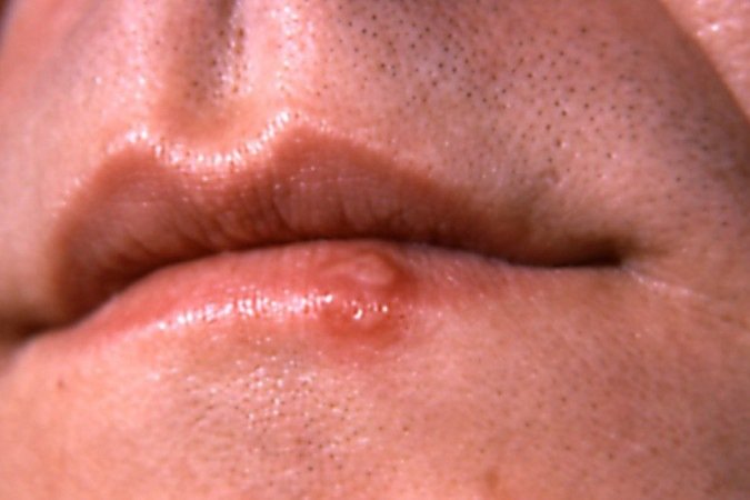  (crédito: Getty Images)