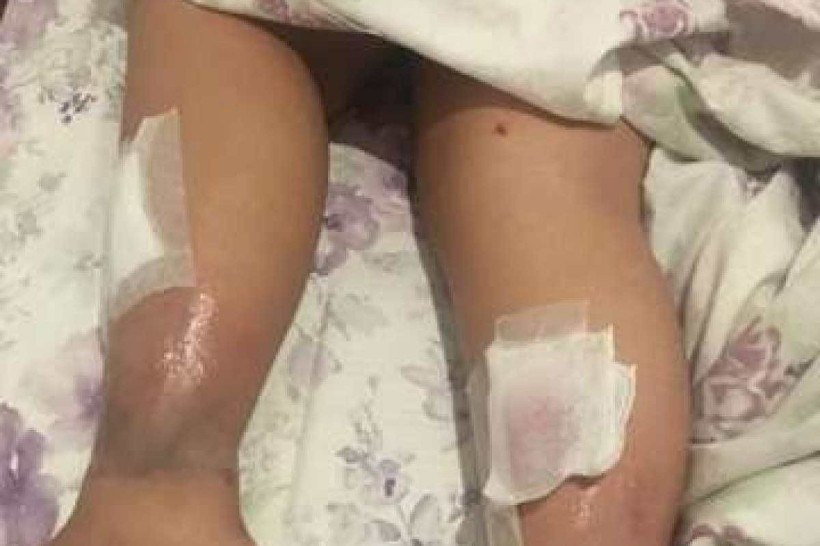 Criança com síndrome de down é atingida por bomba da PM no Mineirão
