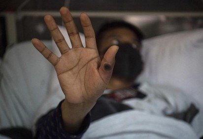 
Varíola dos macacos: Saúde confirma mais 13 casos no DF, totalizando 210 infectados
 -  (crédito: Ernesto BENAVIDES / AFP)