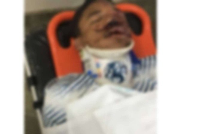 Augusto segue internado na UTI de um hospital particular. - (crédito: Material cedido ao Correio) Augusto segue internado na UTI de um hospital particular. - (crédito: Material cedido ao Correio)
