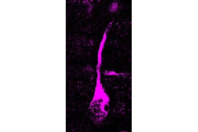 (crédito: Pinson et al., Science 2022 / MPI-CBG) (crédito: Pinson et al., Science 2022 / MPI-CBG)