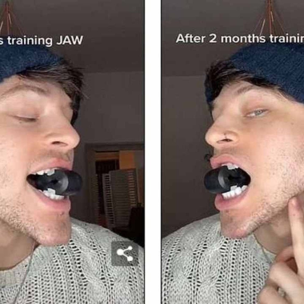 Jawline Exercitador Facial de Mandibula Maxilar Mewing Exercícios
