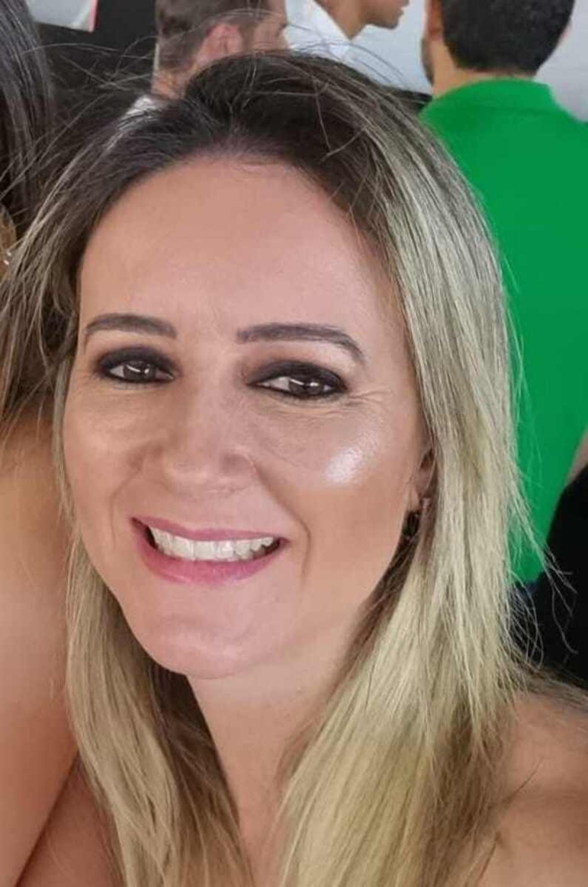 A técnica em vendas Karla de Carvalho aprovou a lipoenxertia realizada nos glúteos A técnica em vendas Karla de Carvalho aprovou a lipoenxertia realizada nos glúteos
