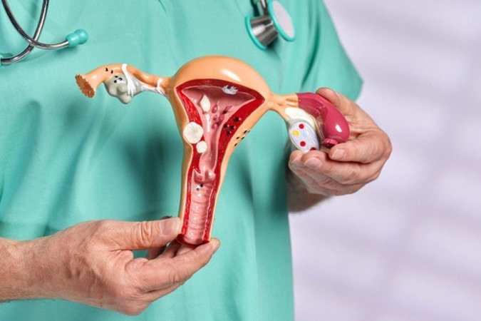 A síndrome de Rokitansky é uma má formação congênita, que provoca a ausência do útero ou um desenvolvimento incompleto de uma porção da vagina.
crédito: GETTY IMAGES
- A síndrome de Rokitansky é uma má formação congênita, que provoca a ausência do útero ou um desenvolvimento incompleto de uma porção da vagina.
crédito: GETTY IMAGES
-
