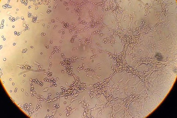  (crédito:  Fiocruz/Direitos reservados)