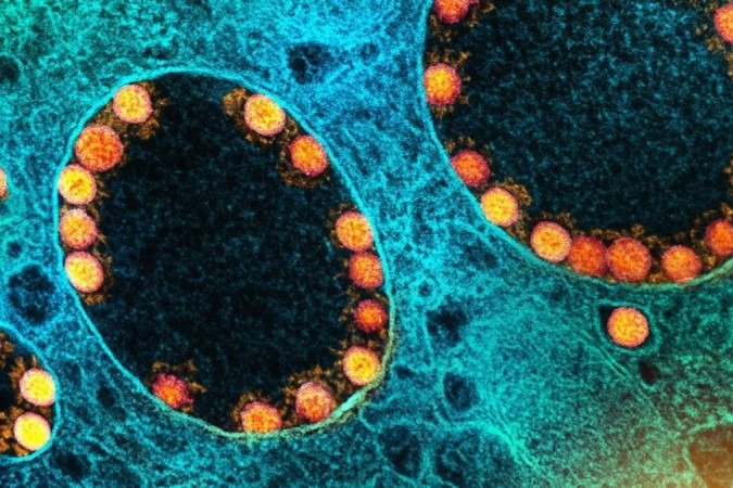  (crédito: NIAD-National Institute of Allergy and Infectious)