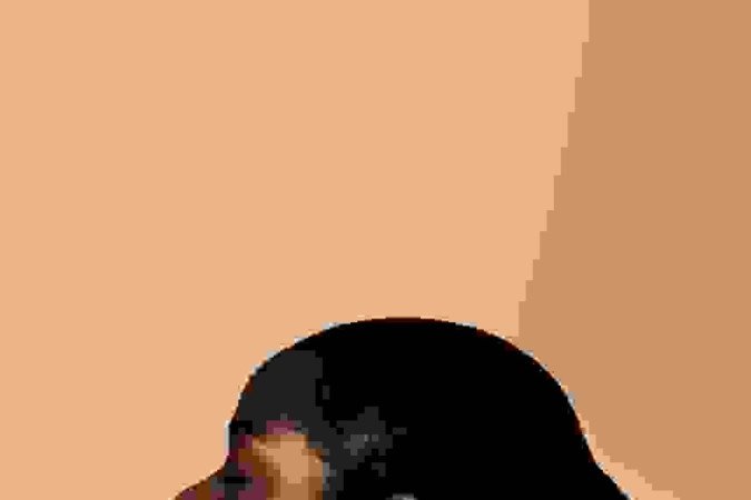 Há condições dermatológicas que são mais comuns às peles pretas 