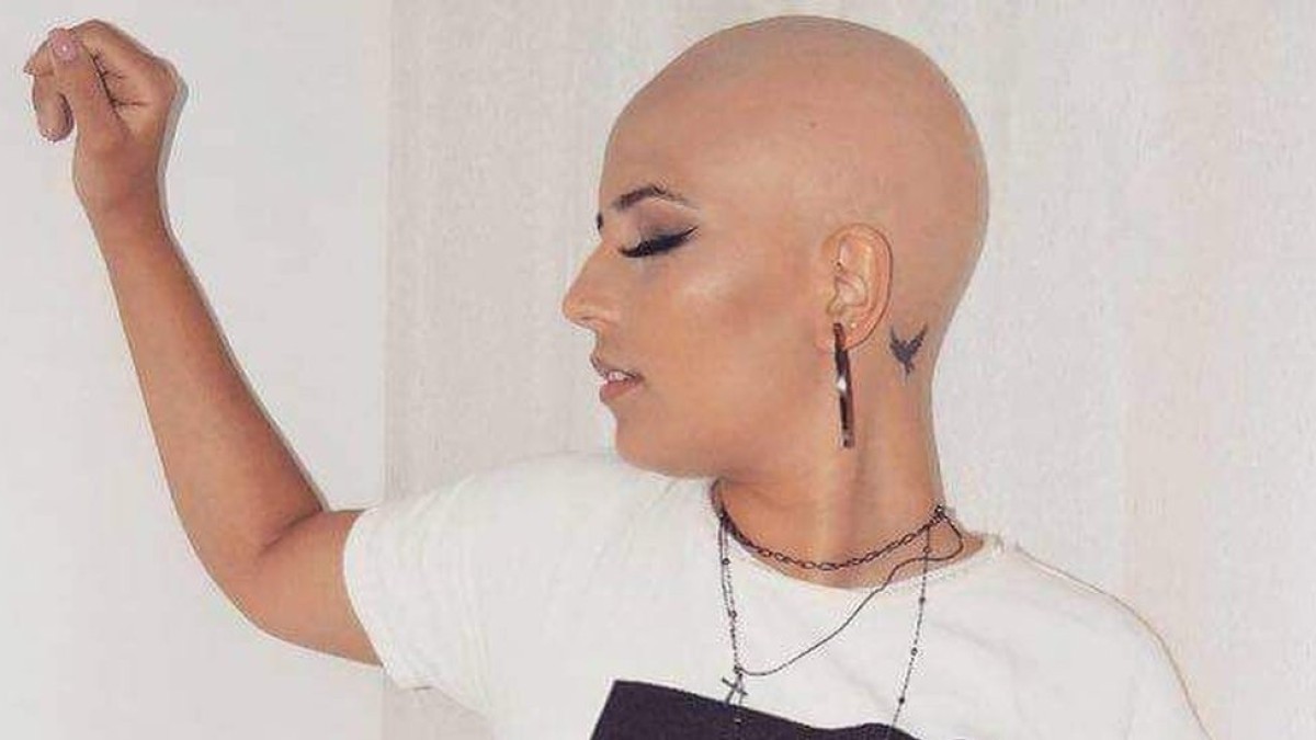 Cabeleireira fica careca após diagnóstico de alopecia: 'perdi os fios e minhas clientes'