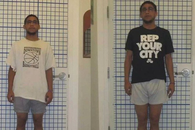 Sam ou por uma cirurgia que o ajudou a ganhar alguns centímetros - Sam ou por uma cirurgia que o ajudou a ganhar alguns centímetros -